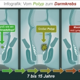 Darmkrebs